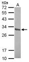 Zinc Finger Protein 414 antibody, NBP2-21009, Novus Biologicals, Western Blot image 