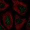 CCR4-NOT Transcription Complex Subunit 7 antibody, HPA069543, Atlas Antibodies, Immunocytochemistry image 