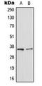 Galectin 8 antibody, LS-C354013, Lifespan Biosciences, Western Blot image 