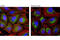 Sequestosome 1 antibody, 7695S, Cell Signaling Technology, Immunocytochemistry image 