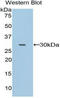 CD32a antibody, LS-B14608, Lifespan Biosciences, Western Blot image 