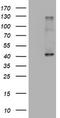 Alpha-1,4-N-Acetylglucosaminyltransferase antibody, TA800414BM, Origene, Western Blot image 