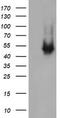 Ciliogenesis Associated TTC17 Interacting Protein antibody, CF505502, Origene, Western Blot image 