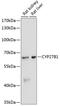 Cytochrome P450 Family 27 Subfamily B Member 1 antibody, 16-876, ProSci, Western Blot image 