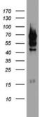 Poly(A)-Specific Ribonuclease antibody, MA5-26544, Invitrogen Antibodies, Western Blot image 