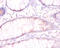 Tubulin Beta 3 Class III antibody, A53965-100, Epigentek, Immunohistochemistry paraffin image 