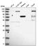 Erythrocyte Membrane Protein Band 4.1 antibody, NBP2-55092, Novus Biologicals, Western Blot image 