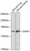 Death Associated Protein Kinase 1 antibody, GTX54047, GeneTex, Western Blot image 