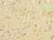 Fc Fragment Of IgG Receptor IIb antibody, LS-C677923, Lifespan Biosciences, Immunohistochemistry paraffin image 