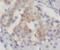 WAP Four-Disulfide Core Domain 3 antibody, FNab09508, FineTest, Immunohistochemistry paraffin image 