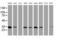 Palmitoyl-Protein Thioesterase 1 antibody, MA5-26457, Invitrogen Antibodies, Western Blot image 