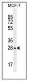 LGALS3 antibody, AP52468PU-N, Origene, Western Blot image 