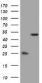 3-Oxoacyl-ACP Synthase, Mitochondrial antibody, TA802243S, Origene, Western Blot image 