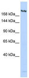 KDM6B antibody, TA345639, Origene, Western Blot image 