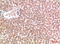 Ectopic P-Granules Autophagy Protein 5 Homolog antibody, STJ98818, St John