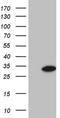 GLYAT antibody, NBP2-45897, Novus Biologicals, Western Blot image 
