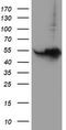 Histidyl-TRNA Synthetase 2, Mitochondrial antibody, TA503835, Origene, Western Blot image 