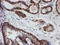 ATR Interacting Protein antibody, TA504641, Origene, Immunohistochemistry paraffin image 