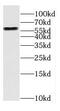 Sterol 26-hydroxylase, mitochondrial antibody, FNab02154, FineTest, Western Blot image 