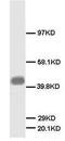 Growth Associated Protein 43 antibody, AP23239PU-N, Origene, Western Blot image 