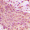 p65 antibody, LS-C352793, Lifespan Biosciences, Immunohistochemistry paraffin image 
