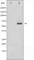 X-Linked Inhibitor Of Apoptosis antibody, abx011749, Abbexa, Western Blot image 