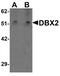 Developing Brain Homeobox 2 antibody, PA5-34391, Invitrogen Antibodies, Western Blot image 