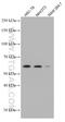 Cyclin Dependent Kinase Inhibitor 1C antibody, 66794-1-Ig, Proteintech Group, Western Blot image 
