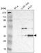 CDK-activating kinase assembly factor MAT1 antibody, HPA000701, Atlas Antibodies, Western Blot image 