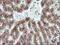 Cytochrome P450 Family 2 Subfamily B Member 6 antibody, M00861, Boster Biological Technology, Immunohistochemistry paraffin image 