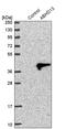 Abhydrolase Domain Containing 13 antibody, PA5-56943, Invitrogen Antibodies, Western Blot image 