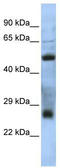 Testis Expressed 47 antibody, TA329776, Origene, Western Blot image 