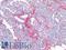 Collagen Type I Alpha 1 Chain antibody, LS-B5932, Lifespan Biosciences, Immunohistochemistry paraffin image 