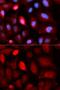 PDZ and LIM domain protein 5 antibody, GTX54578, GeneTex, Immunocytochemistry image 