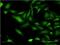 Cholinergic Receptor Nicotinic Beta 3 Subunit antibody, H00001142-M01, Novus Biologicals, Immunocytochemistry image 