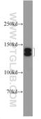 Phosphorylase Kinase Regulatory Subunit Alpha 1 antibody, 24279-1-AP, Proteintech Group, Western Blot image 