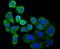 Protein transport protein Sec23A antibody, A05287-1, Boster Biological Technology, Immunocytochemistry image 