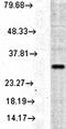 Heme Oxygenase 1 antibody, orb67509, Biorbyt, Western Blot image 