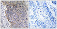 Microsomal Glutathione S-Transferase 3 antibody, abx014582, Abbexa, Western Blot image 