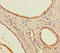 Orthodenticle Homeobox 2 antibody, A55299-100, Epigentek, Immunohistochemistry paraffin image 