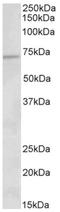Very long-chain specific acyl-CoA dehydrogenase, mitochondrial antibody, AP32801PU-N, Origene, Western Blot image 