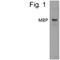 Maltose Binding Protein antibody, PA1-989, Invitrogen Antibodies, Western Blot image 