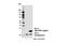 Ribosomal Protein L11 antibody, 18163S, Cell Signaling Technology, Western Blot image 