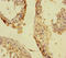 Polyhomeotic-like protein 1 antibody, LS-C679012, Lifespan Biosciences, Immunohistochemistry paraffin image 