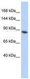 Lysine-specific demethylase 4B antibody, TA344357, Origene, Western Blot image 