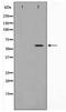 Cell Division Cycle 25A antibody, TA348450, Origene, Western Blot image 