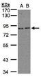 Zyg-11 Related Cell Cycle Regulator antibody, TA307990, Origene, Western Blot image 