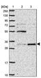 Uridine-cytidine kinase 1 antibody, PA5-62281, Invitrogen Antibodies, Western Blot image 