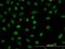 Y-Box Binding Protein 3 antibody, H00008531-M06, Novus Biologicals, Immunofluorescence image 
