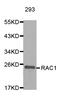Rac Family Small GTPase 1 antibody, TA332748, Origene, Western Blot image 